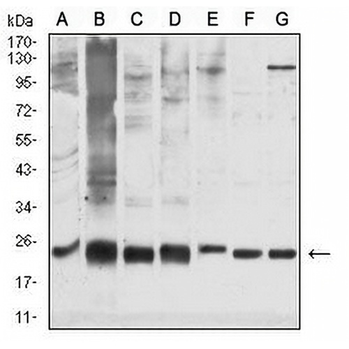 GSTP1 Mouse Monoclonal Antibody(C2727)