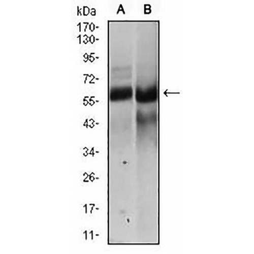 HAS2 Mouse Monoclonal Antibody(C2731)