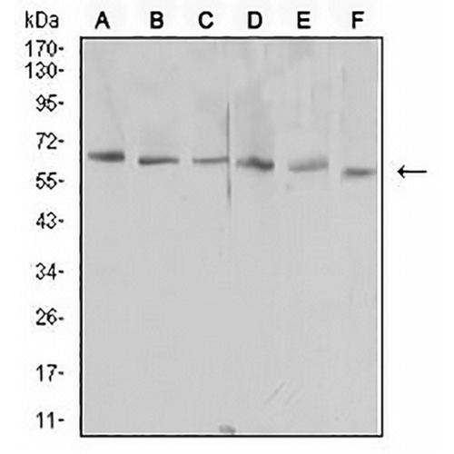 KIM1 Mouse Monoclonal Antibody(C2732)