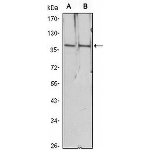 Histone Deacetylase 4 Mouse Monoclonal Antibody(C2735)
