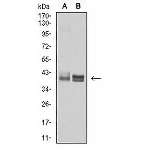 HLA-B Mouse Monoclonal Antibody(C2741)