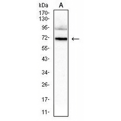 HNF1 beta Mouse Monoclonal Antibody(C2747)