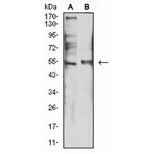 5-HT3B Mouse Monoclonal Antibody(C2755)