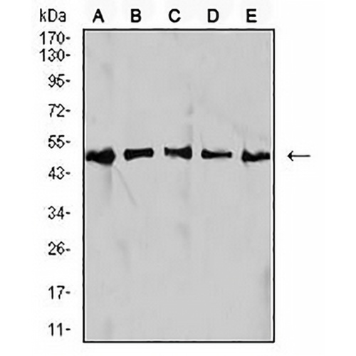 IDH1 Mouse Monoclonal Antibody(C2758)