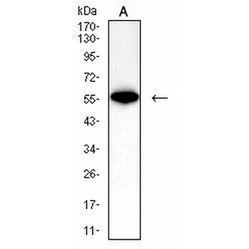 IFNAR1 Mouse Monoclonal Antibody(C2759)