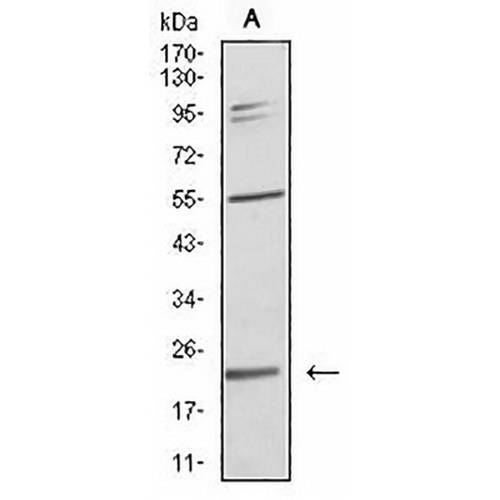 IL-28A Mouse Monoclonal Antibody(C2760)