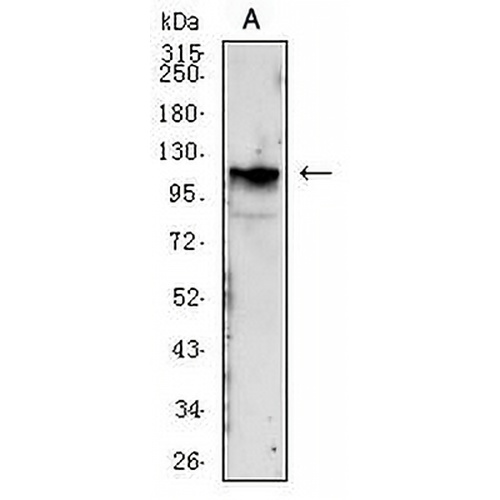 IGF1 Receptor Mouse Monoclonal Antibody(C2761)
