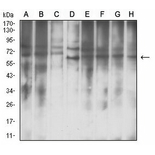 IGF2BP3 Mouse Monoclonal Antibody(C2762)