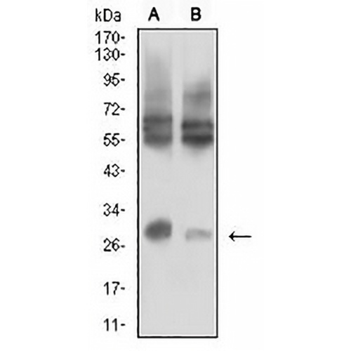 CD215 Mouse Monoclonal Antibody(C2766)