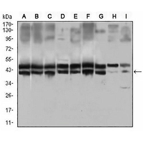 CD25 Mouse Monoclonal Antibody(C2770)