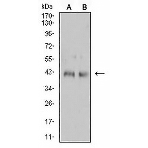 CD132 Mouse Monoclonal Antibody(C2771)