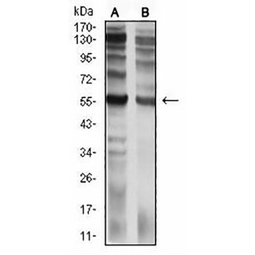 CD129 Mouse Monoclonal Antibody(C2775)