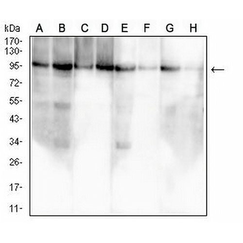 Insulin Receptor Mouse Monoclonal Antibody(C2776)