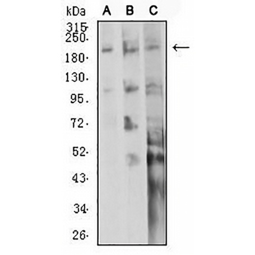 CD104 Mouse Monoclonal Antibody(C2783)