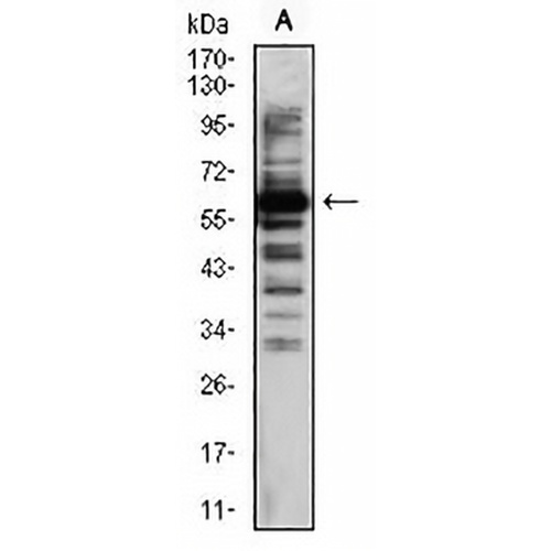 TIP60 Mouse Monoclonal Antibody(C2787)