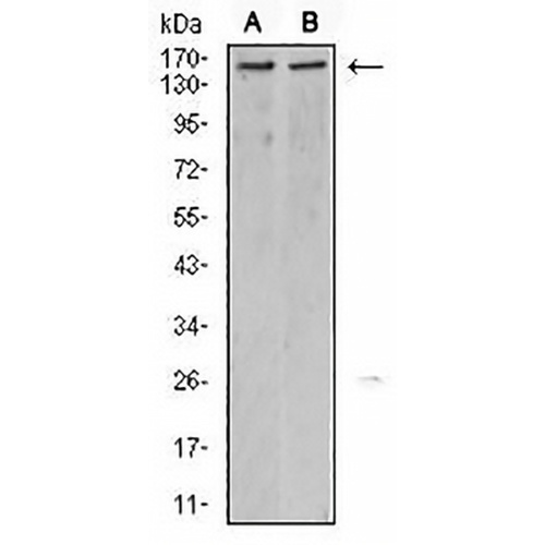 KDM6A Mouse Monoclonal Antibody(C2794)
