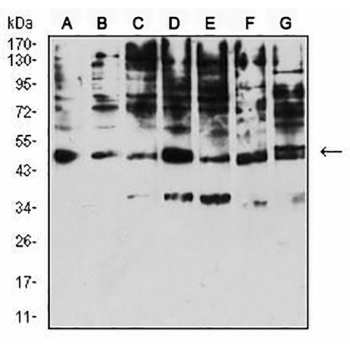 CD158e Mouse Monoclonal Antibody(C2796)