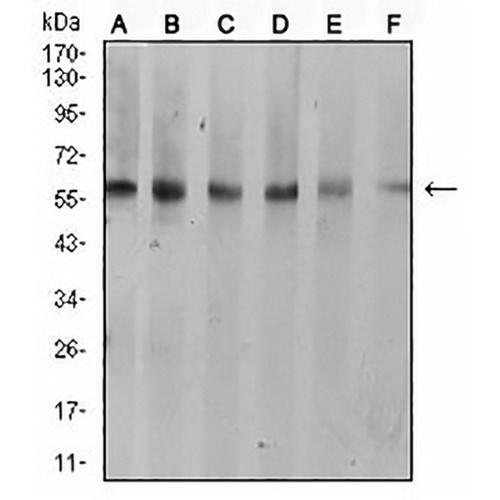 Cytokeratin 10 Mouse Monoclonal Antibody(C2801)