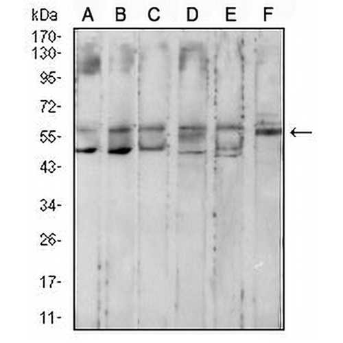 Cytokeratin 10 Mouse Monoclonal Antibody(C2802)
