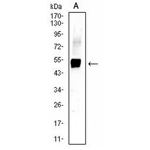 Cytokeratin 13 Mouse Monoclonal Antibody(C2803)