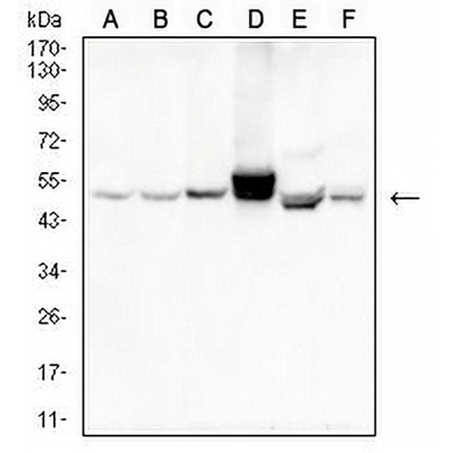 Cytokeratin 14 Mouse Monoclonal Antibody(C2804)