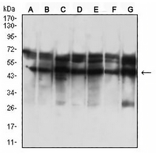 Cytokeratin 18 Mouse Monoclonal Antibody(C2806)