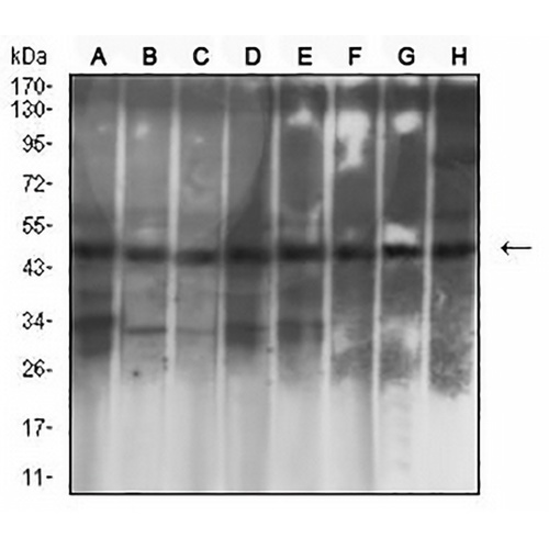 Cytokeratin 19 Mouse Monoclonal Antibody(C2807)