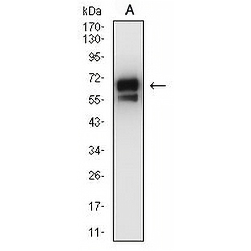 Cytokeratin 2 Mouse Monoclonal Antibody(C2808)