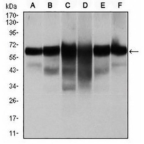Cytokeratin 5 Mouse Monoclonal Antibody(C2809)