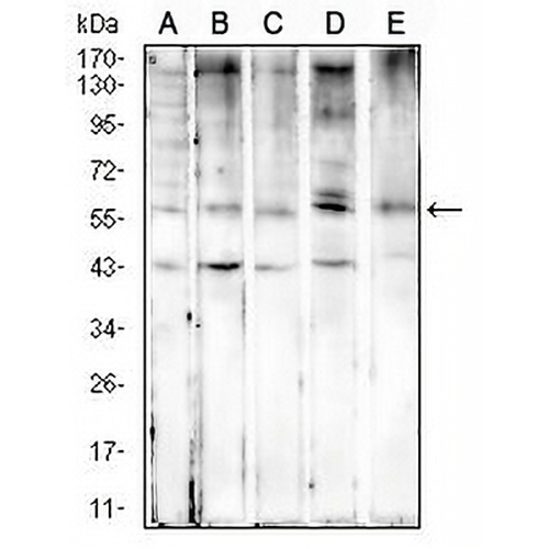 Cytokeratin 6 Mouse Monoclonal Antibody(C2810)