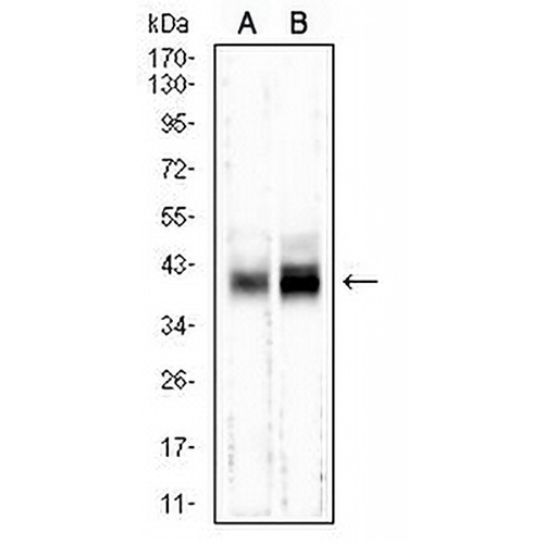 M6PR Mouse Monoclonal Antibody(C2823)