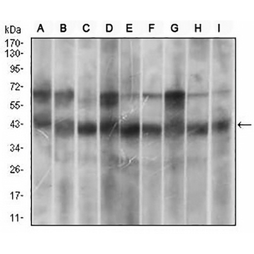 p38 Mouse Monoclonal Antibody(C2829)