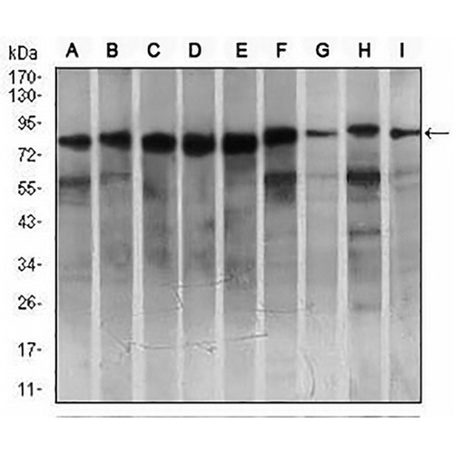 MARK3 Mouse Monoclonal Antibody(C2832)