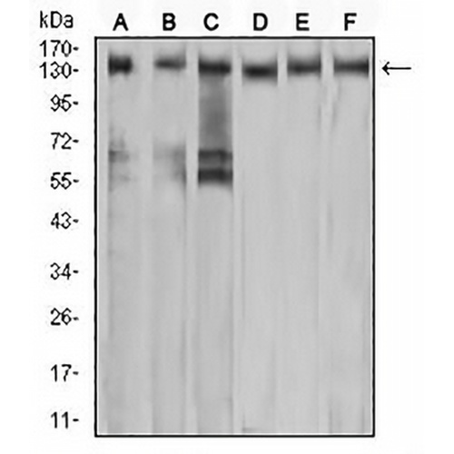 c-Met Mouse Monoclonal Antibody(C2839)