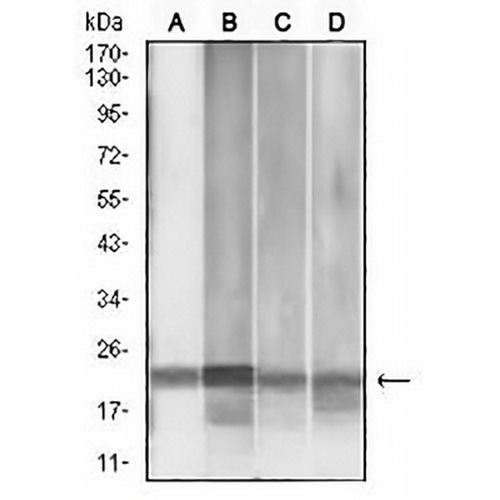 MGMT Mouse Monoclonal Antibody(C2840)