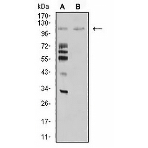MIB1 Mouse Monoclonal Antibody(C2841)