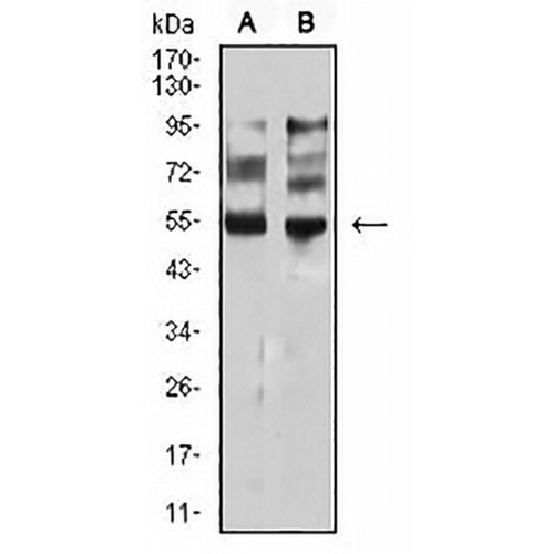MITF Mouse Monoclonal Antibody(C2842)