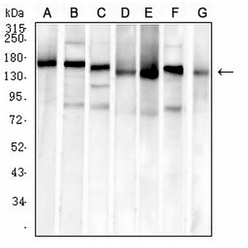 MSH6 Mouse Monoclonal Antibody(C2851)