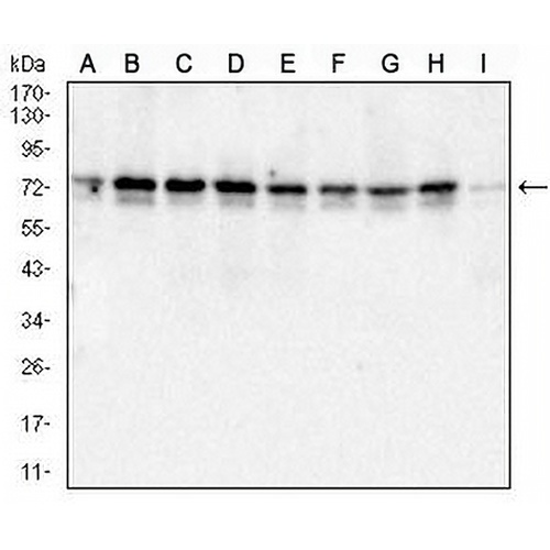Metadherin Mouse Monoclonal Antibody(C2858)
