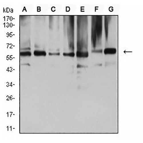 ARD1 Mouse Monoclonal Antibody(C2861)