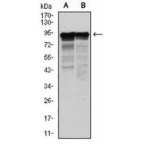 NEFL Mouse Monoclonal Antibody(C2870)
