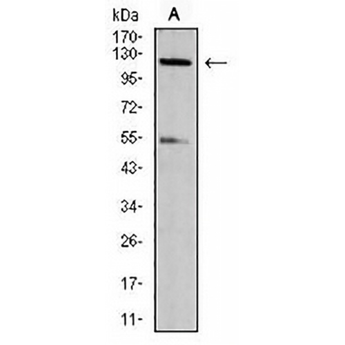 CARD12 (Phospho-S533) Rat Monoclonal Antibody(C2874)