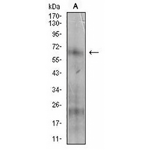 CD73 Mouse Monoclonal Antibody(C2878)