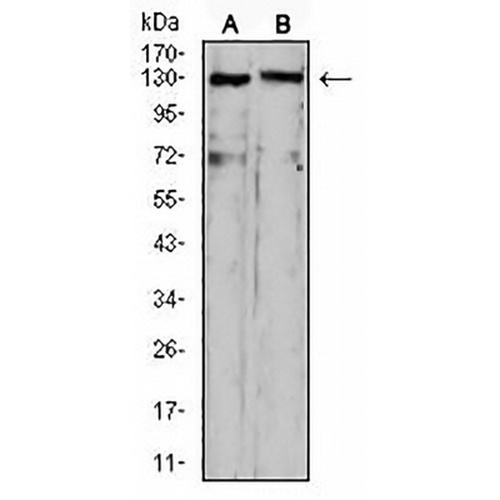 OTUD4 Mouse Monoclonal Antibody(C2881)