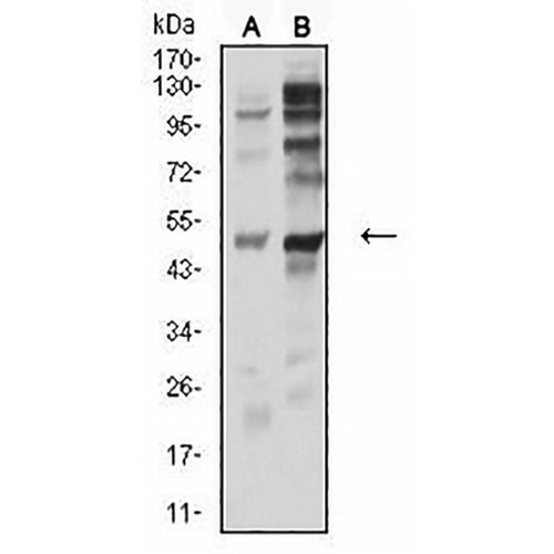 P2Y12 Mouse Monoclonal Antibody(C2884)