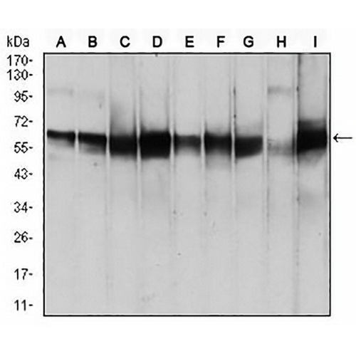 PDPK1 Mouse Monoclonal Antibody(C2900)