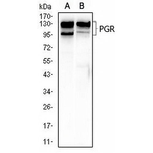 Progesterone Receptor Mouse Monoclonal Antibody(C2902)