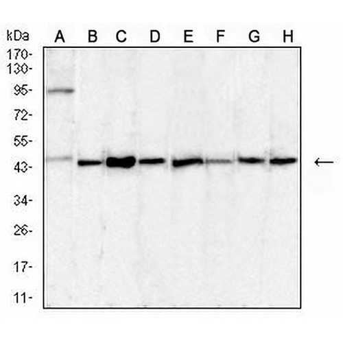 uPA Mouse Monoclonal Antibody(C2905)