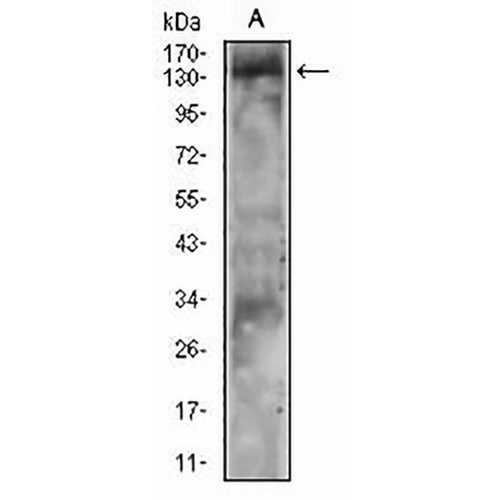 PLC gamma 2 Mouse Monoclonal Antibody(C2908)
