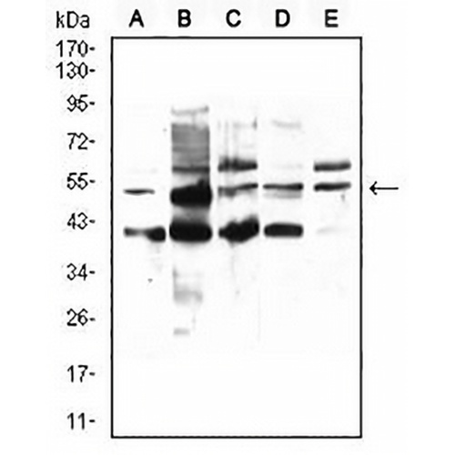 PPAR alpha Mouse Monoclonal Antibody(C2915)